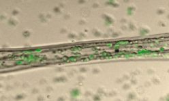 Biomaterials